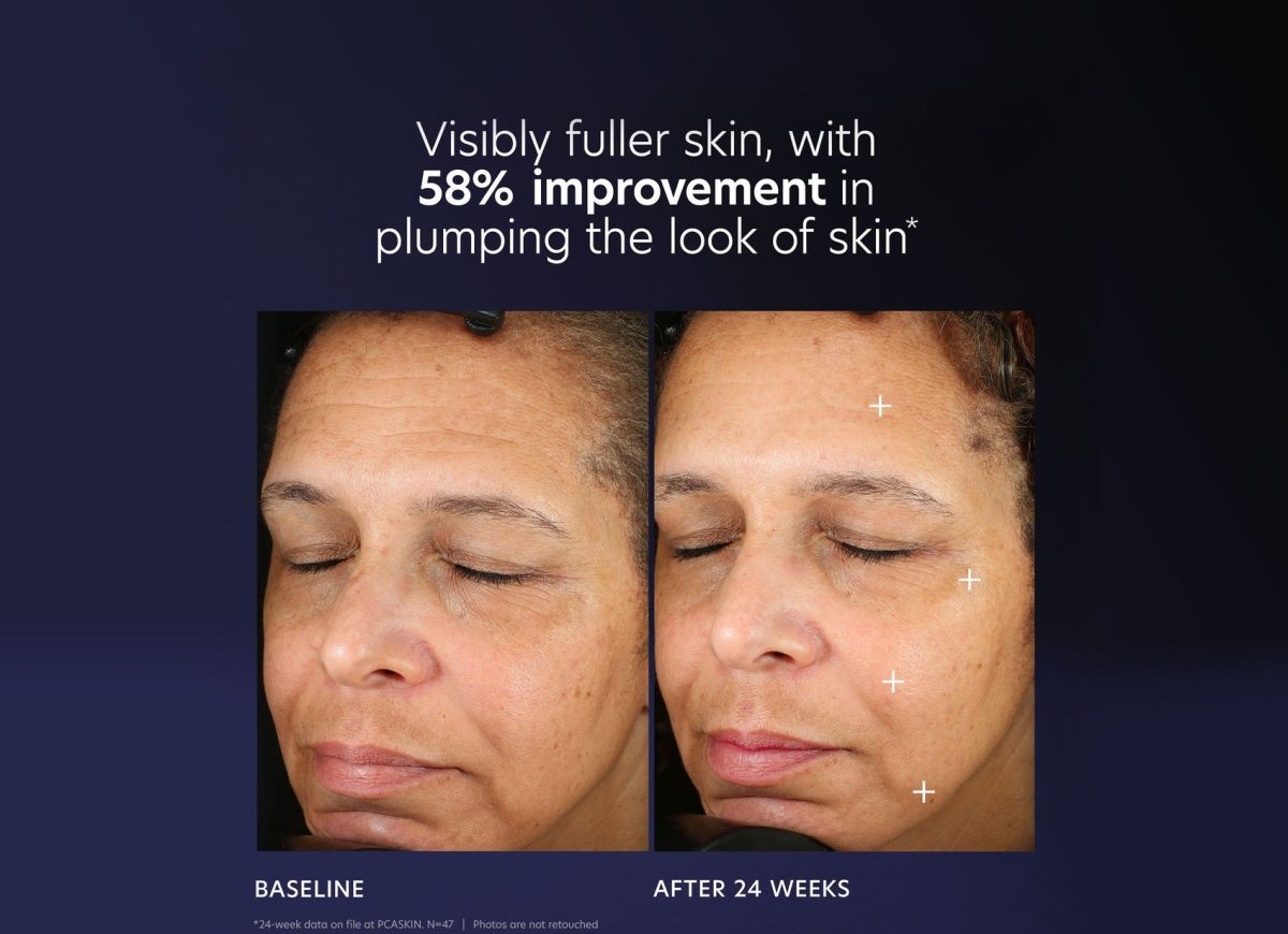 PCA Skin Pro-Max Age Renewal - Görsel 4
