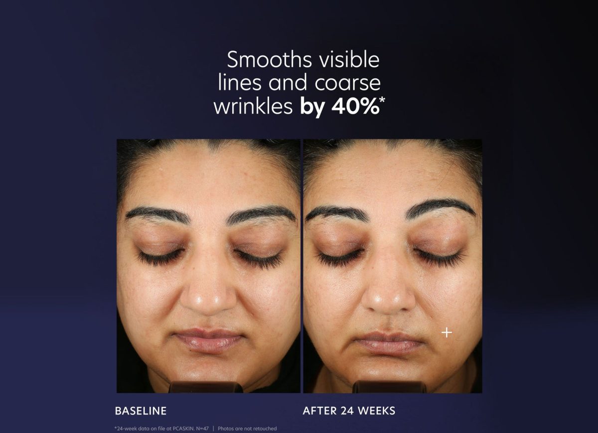 PCA Skin Pro-Max Age Renewal - Görsel 5